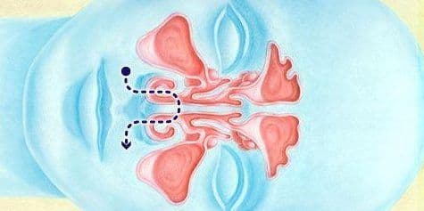 Як правильно промивати ніс в домашніх умовах