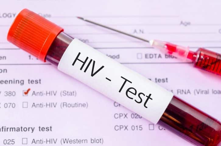 Як запропонувати партнеру здати тест на ВІЛ
